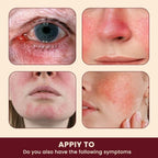 Sumifun - Rosacea Relief Ointment (Original)